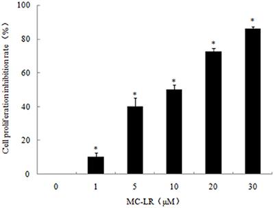 Novel Role of ER Stress and Autophagy in Microcystin-LR Induced Apoptosis in Chinese Hamster Ovary Cells